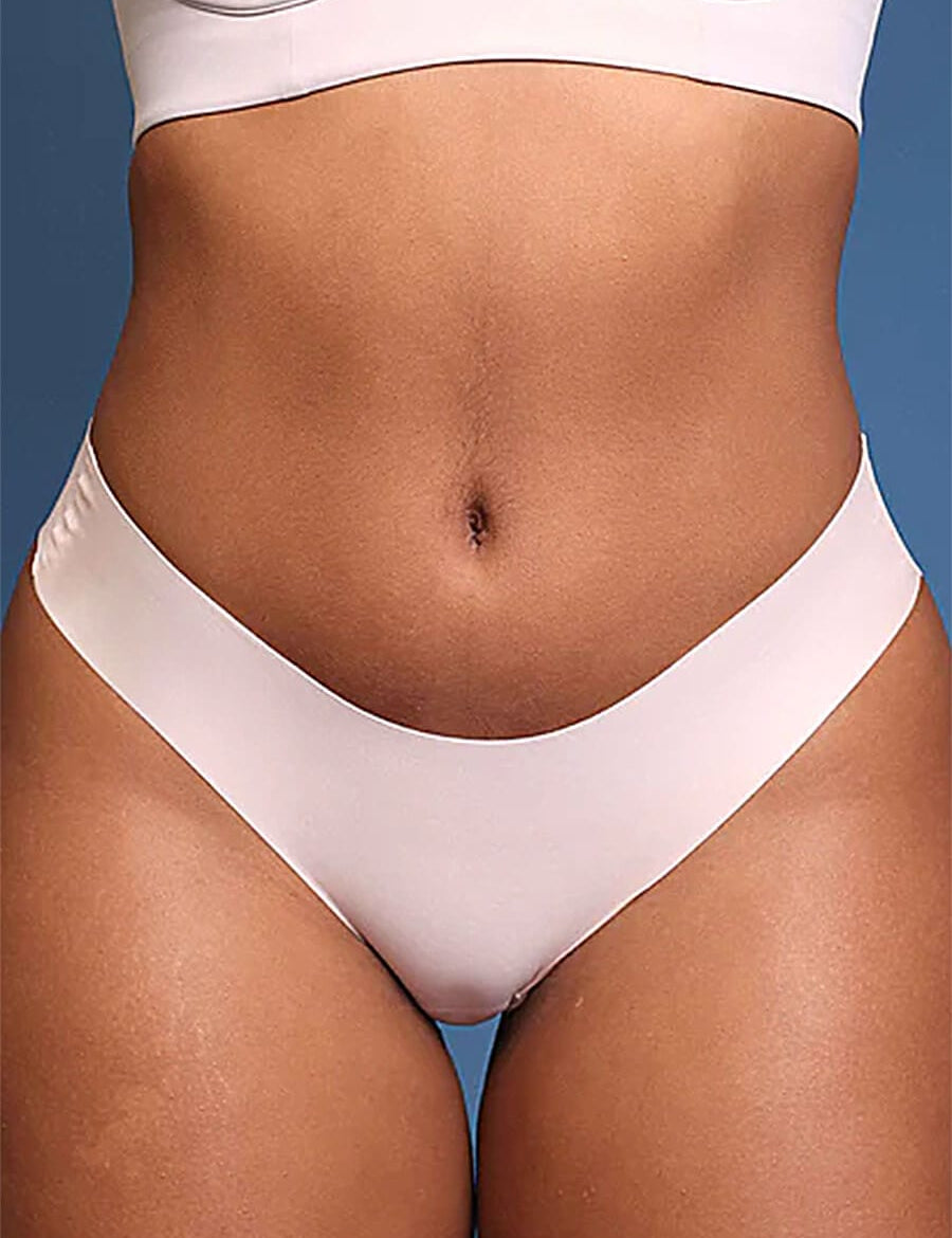 AFZ®IntimaLuxe AirWear Free Cut Bikini