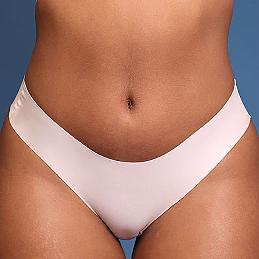 AFZ®IntimaLuxe AirWear Free Cut Bikini